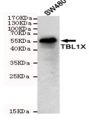 TBL1 Mouse mAb