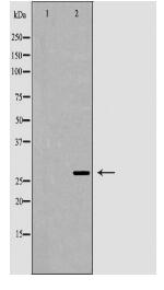 CLEC4A Antibody