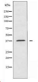 ALDOA Antibody