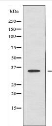 AKR1B1 Antibody