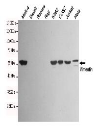 Vimentin Mouse mAb