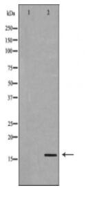 BIRC5 Antibody