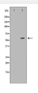 DKC1 Antibody