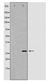 ARHGDIA Antibody