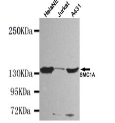 SMC1A(N-term) Mouse mAb