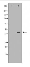 BAG1 Antibody