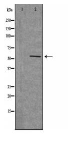 CHRNB1 Antibody