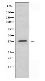 ABHD6 Antibody