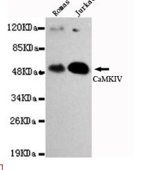 CaMKIV Mouse mAb