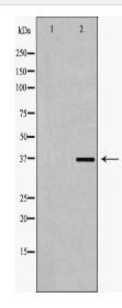 AKR1C3 Antibody
