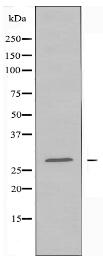 CDCA3 Antibody