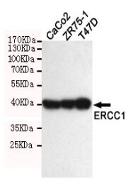 ERCC1 Mouse mAb