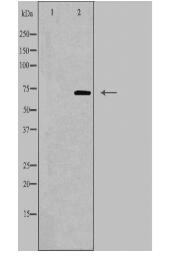 Collagen XIII α1 Antibody