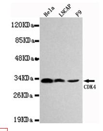 CDK4 Mouse mAb