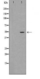 ACPP Antibody