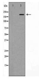 BRCA1 Antibody