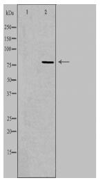 CEP78 Antibody