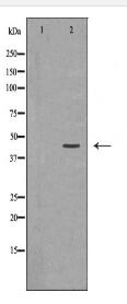 AGER Antibody