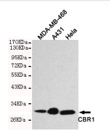 CBR1 Mouse mAb