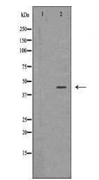 ADIPOR1 Antibody