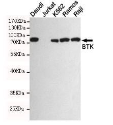 BTK Mouse mAb