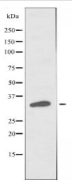 DNAJC17 Antibody
