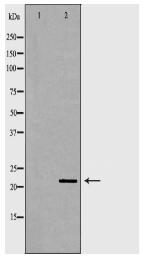 CBX5 Antibody