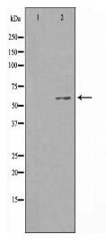 CCDC102B Antibody