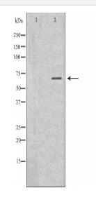 AFP Antibody