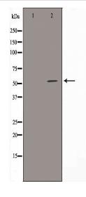 ALDH3B1 Antibody