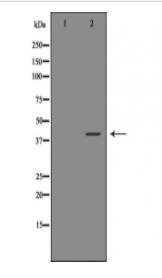 ATF4 Antibody