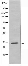 CKLF6 Antibody