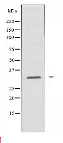 ABCC13 Antibody
