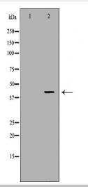 ABO Antibody