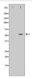 BMPR1B Antibody