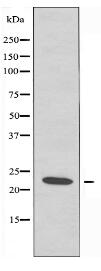 CHP2 Antibody