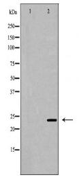 CDKN3 Antibody