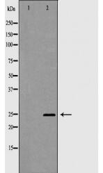 CLEC4D Antibody