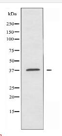 A4GNT Antibody