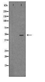 ARRB2 Antibody