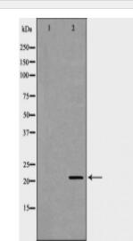 DHFR Antibody