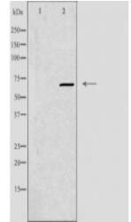 EWSR1 Antibody