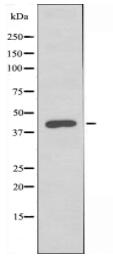 B3GALT4 Antibody
