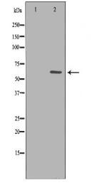 CHEK2 Antibody