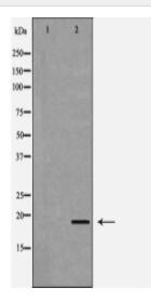 C19orf10 Antibody