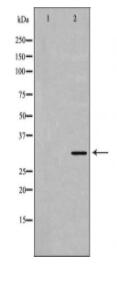 GEMIN2 Antibody