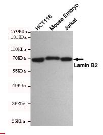 Lamin B2 Mouse mAb