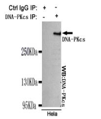 Aldehyde dehydrogenase 10 Mouse mAb