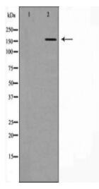 DLC1 Antibody