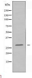 14-3-3 β Antibody